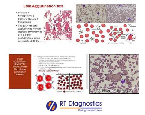 Cold Agglutination | RT Diagnostics