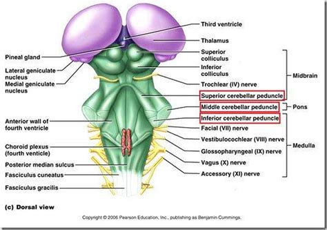 Pictures Of Cerebellar PedunclesHealthiack