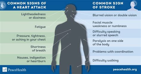 Know and respond to common stroke and heart attack symptoms | PeaceHealth