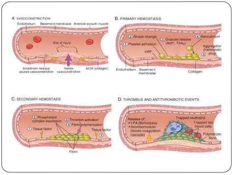 Stages Of Thrombus Formation – Beinyu.com