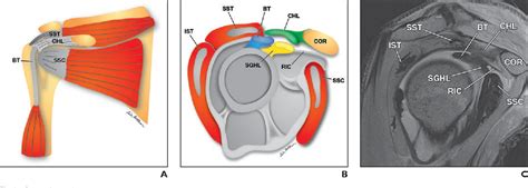 Figure 1 from The rotator interval: a review of anatomy, function, and normal and abnormal MRI ...