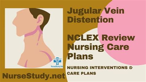 Jugular Vein Distention JVD Nursing Diagnosis and Nursing Care Plan - NurseStudy.Net