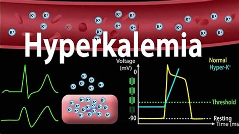 Hyperkalemia causes, signs, symptoms, ECG changes and treatment