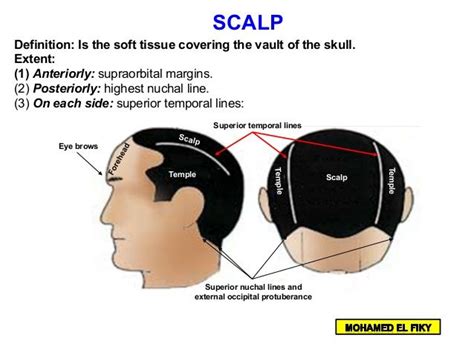 Eye brows Superior nuchal lines and external occipital protuberance ...