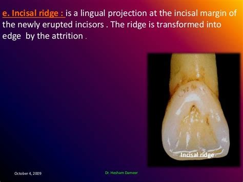 Anatomical landmarks of the crown