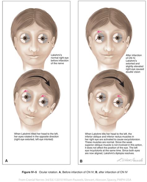 Cranial Nerves 3rd Edition: Trochlear IV