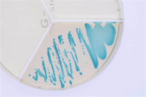 Streptococcus dysgalactiae - ClearMilkTest