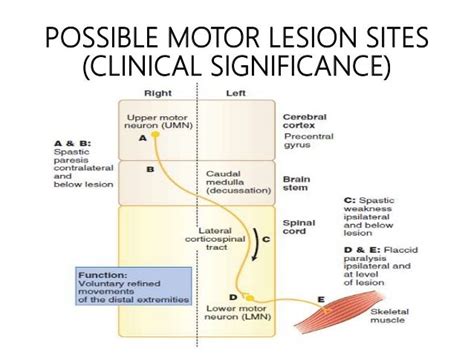 Upper and Lower motor neuron lesions