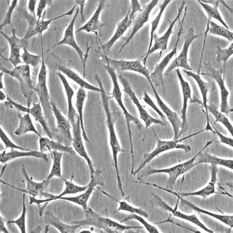 Human Trabecular Meshwork Cells - Innoprot Primary Ocular Cell System