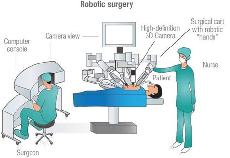 Robotic Approach Falls Short For Gastric Sleeve