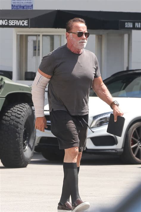 Arnold Schwarzenegger, 76, spotted with bandaged arm in LA days after 'secret surgery' in ...