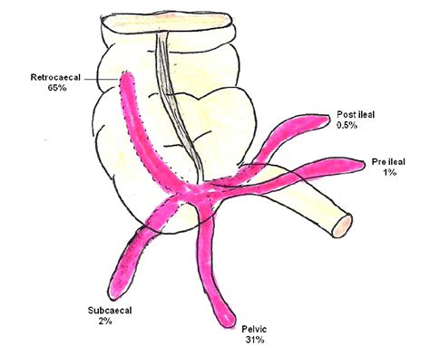 Appendix Location Diagram