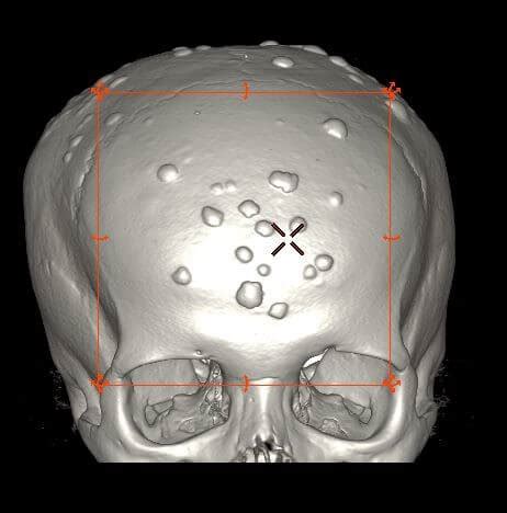 December 2015 – 3D and Quantitative Imaging Laboratory