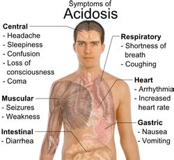 Lactic Acidosis - Diabetic Live