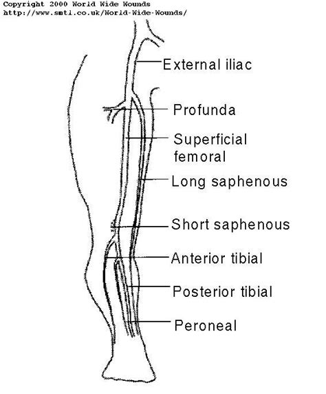 RadiologySpirit: Assessing the lower-limb veins for incompetence