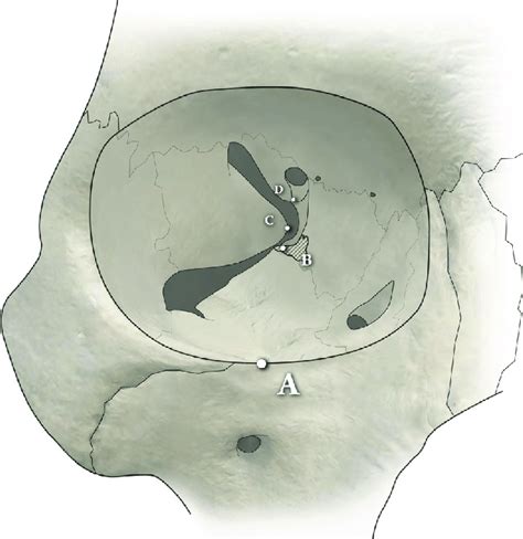 Identification of orbital landmarks. A, Superior aspect of the ...