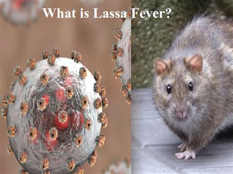 Lassa Fever Explained: Symptoms, Treatment, and Recent US Case | 2024