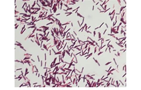 Bacillus Cereus Simple Stain