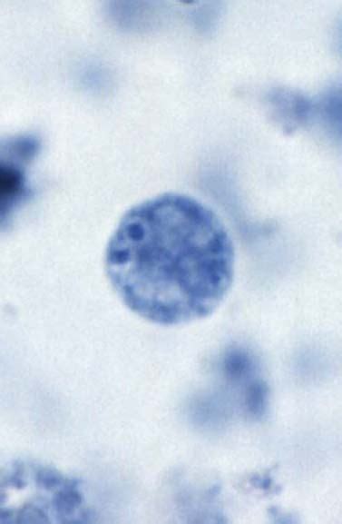 Dientamoeba Fragilis Diagram