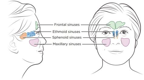 Sinus tumor removal surgery in Iran with Dr. Saeedi