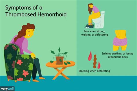 Thrombosed Hemorrhoid: Symptoms, Causes, Diagnosis