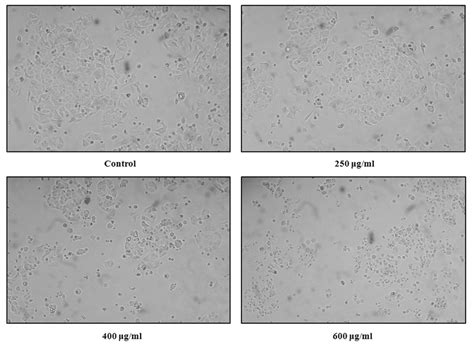 Morphological changes of MCF7 cells after treatment for 24 h with 250 ...