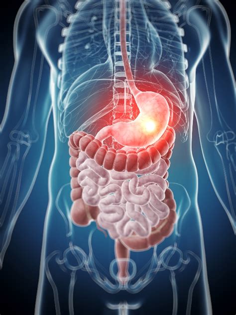 Gastrointestinal Stromal Tumor Featured Drugs And Generic | MIMS Malaysia