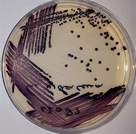 Chromobacterium violaceum (purple pigment) Photo By: Bryan Mangroe. #microbiology # ...