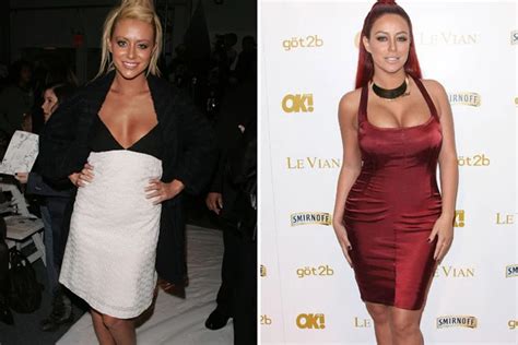 Aubrey O’Day Plastic Surgery Pictures