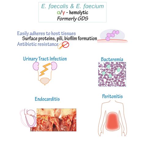 Immunology/Microbiology Glossary: Enterococci | Draw It to Know It