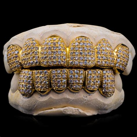 Buy Natural Diamond Grillz - Custom Gold Grillz