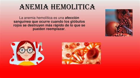 Anemia Hemolítica | Milk Cuellar | uDocz