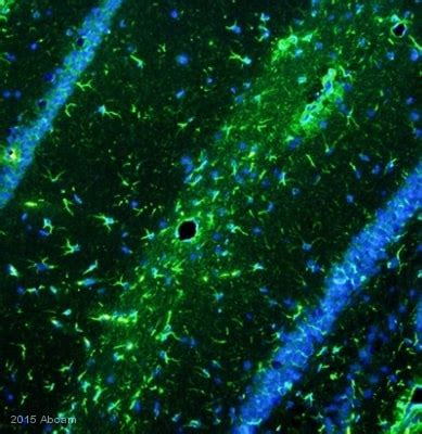 Anti-GFAP antibody (ab7260) | Abcam