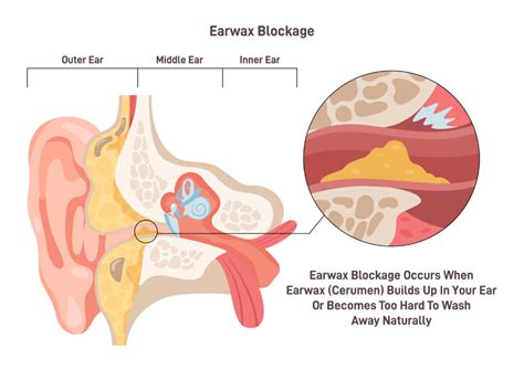 How To Unblock Ears: Here's What You Need to Know! - Crystal Clear Clinic