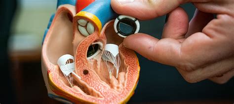 Shanghai artificial heart valve startup NewMed raises over $100 million ...