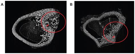 Synchrotron radiation-based microcomputed tomography of a... | Download ...