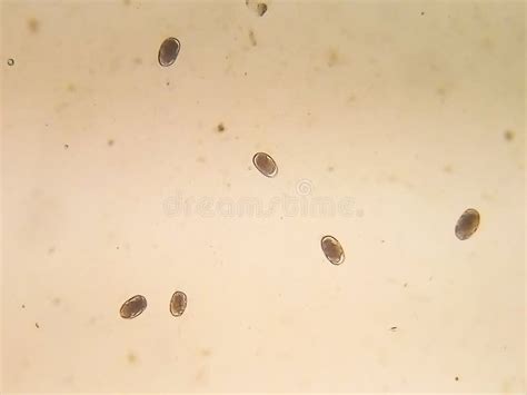 Strongyle Eggs Under the Microscope, Uncinaria/Ancylostoma, Hookworm from Dog`s Feces Sample ...