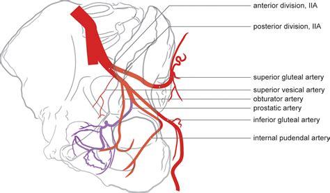 Prostatic Artery Embolization for Benign Prostatic Hyperplasia: Patient Evaluation, Anatomy, and ...