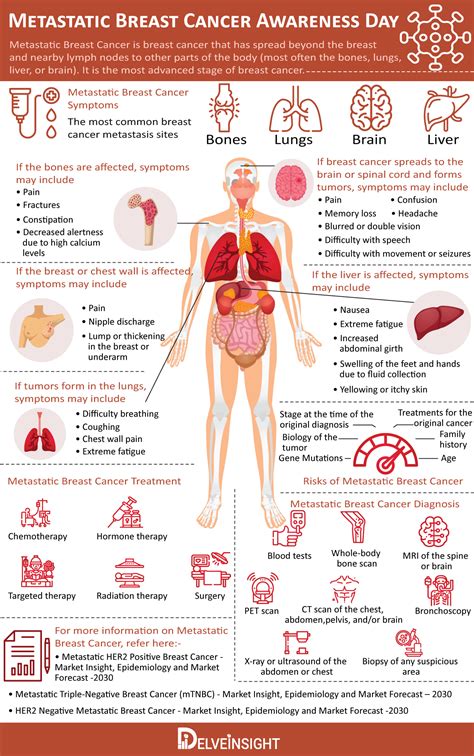 Metastatic Breast Cancer Infographic