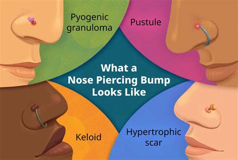 How Long Does It Take For Nose Piercing Bump To Go Away Online | bellvalefarms.com