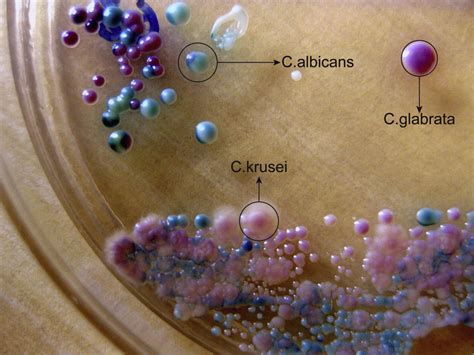 The epidemiology of Candida species associated with vulvovaginal candidiasis in an Iranian ...