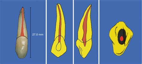 Anatomy and Root Canal Morphology | Pocket Dentistry