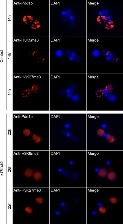 Nuclear localization of histone H3K27 methylation, H3K9 methylation ...