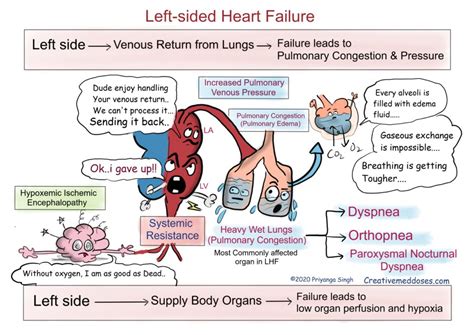 Heart Failure: Left sided VS Right sided - Creative Med Doses