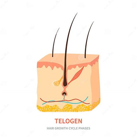 Telogen Hair Growth Phase in a Skin Cross Section Stock Vector - Illustration of removal ...