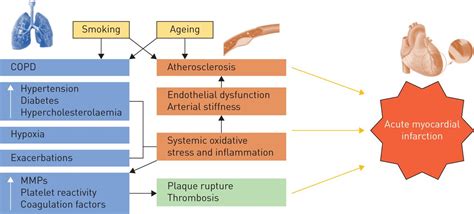 Diagram Pathophysiology Of Myocardial Infarction Ppt : Interleukin 1 ...