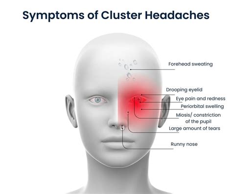 Cluster Headache Treatments in NYC | Pain Management NYC