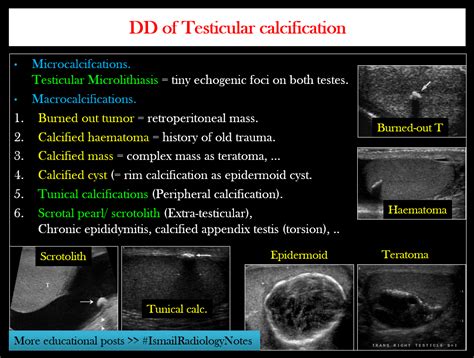 Pin on Scrotal Ultrasound -Dr. Ismail Sayed Ismail