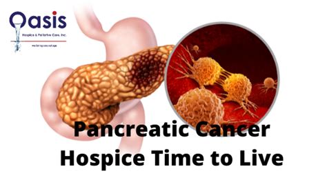 Pancreatic Cancer Hospice Time to Live - Oasis Hospice