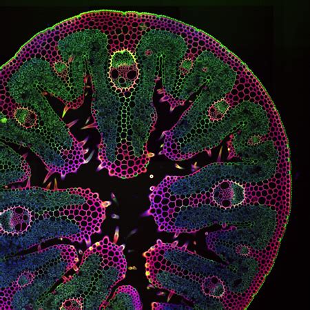 Grass under microscope has many smiley faces | Cheese & Meats